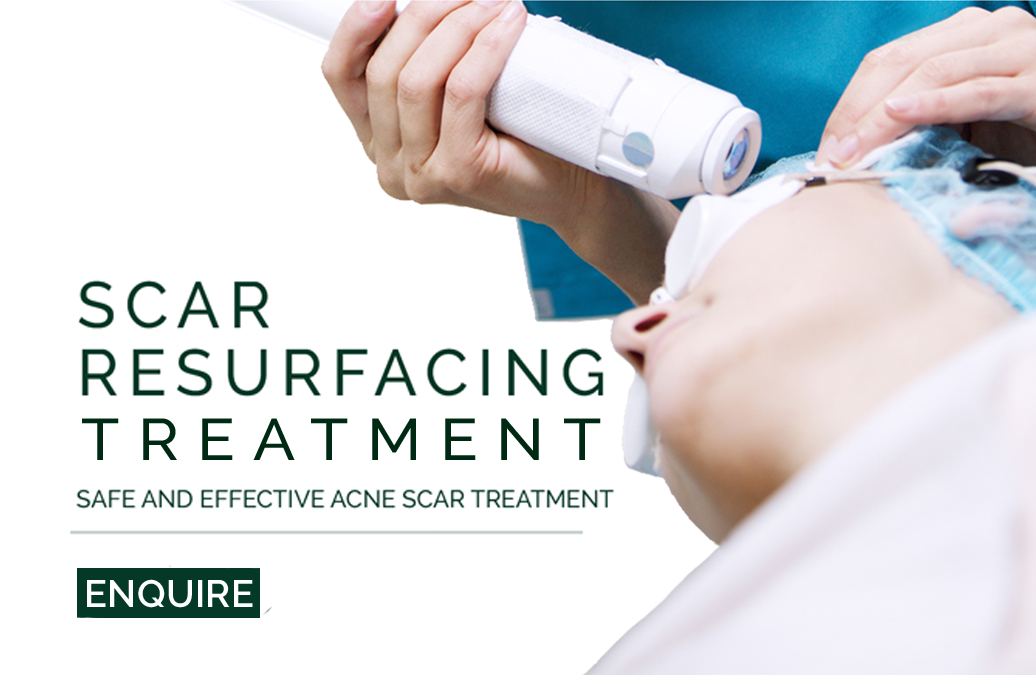 Scar resurfacing micro laser